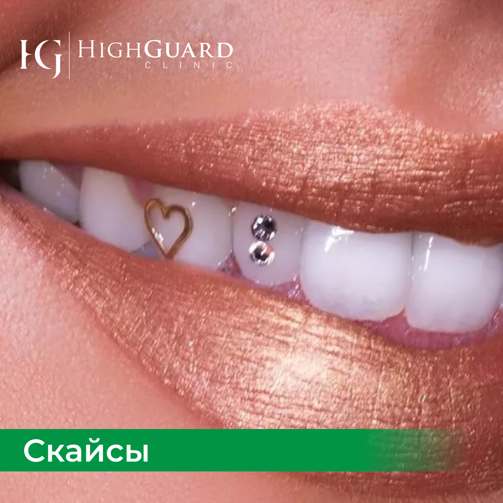 скайсы/стразы