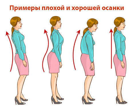 Девушки (слева направо) с 1-3 имеют неправильную осанку, а вот четвертая уже стоит с прямой спиной
