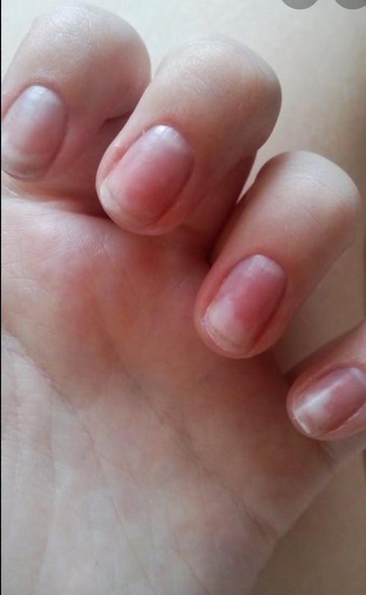 Причины болезненных ощущений в ногтях после маникюра и методы их устранения
