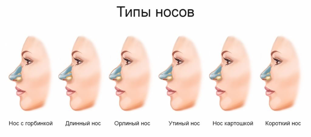 Нос это. Типы Носов курносый. Типы Носов с названиями. Формы Носов. Формы Носов у человека