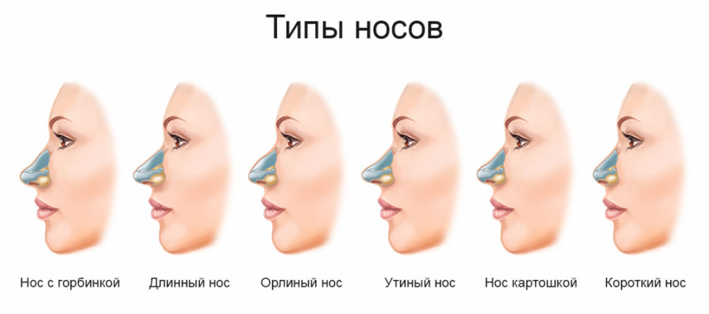 Виды гуди. Формы Носов. Типы Носов курносый. Типы Носов с горбинкой. Формы носа.