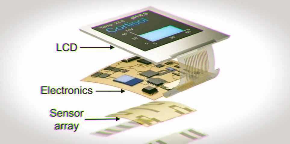 Смарт-часы. (Устройство). TehnoBlog_1303