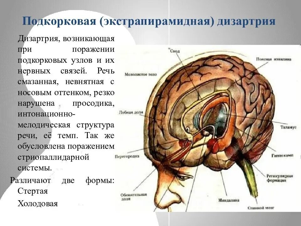 Подкорковые структуры. Локализация поражения при экстрапирамидной дизартрии. Подкорковая экстрапирамидная дизартрия. Локализация поражения при подкорковой дизартрии. Подкорковая дизартрия очаг поражения.