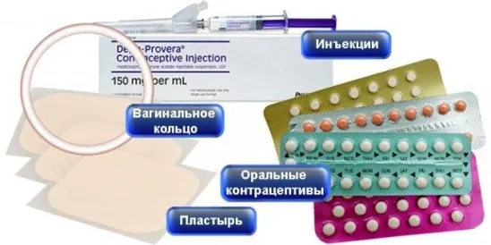 Какие виды средств гормональной контрацепции наиболее удобные и ...