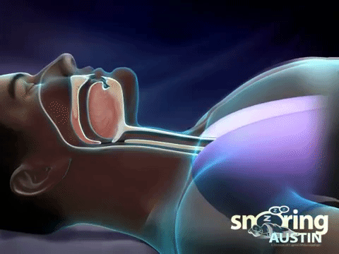 Так воздух проходит в легкие, когда все нормально