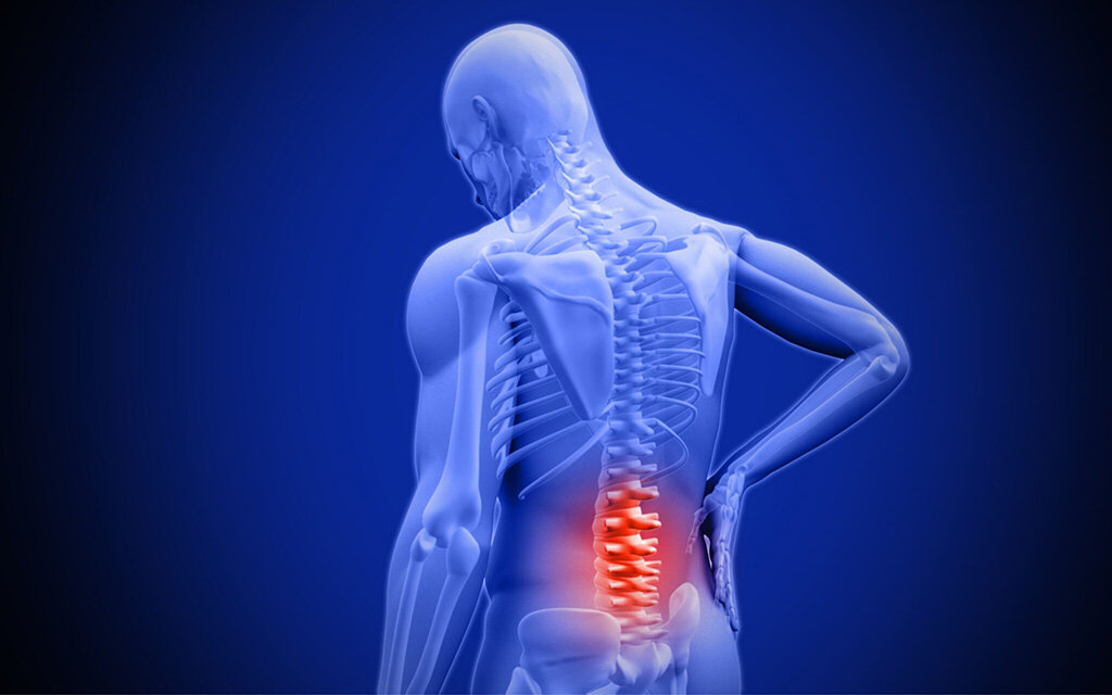 Частая локализация межпозвоночной грыжи. Изображение: prmpractice.com