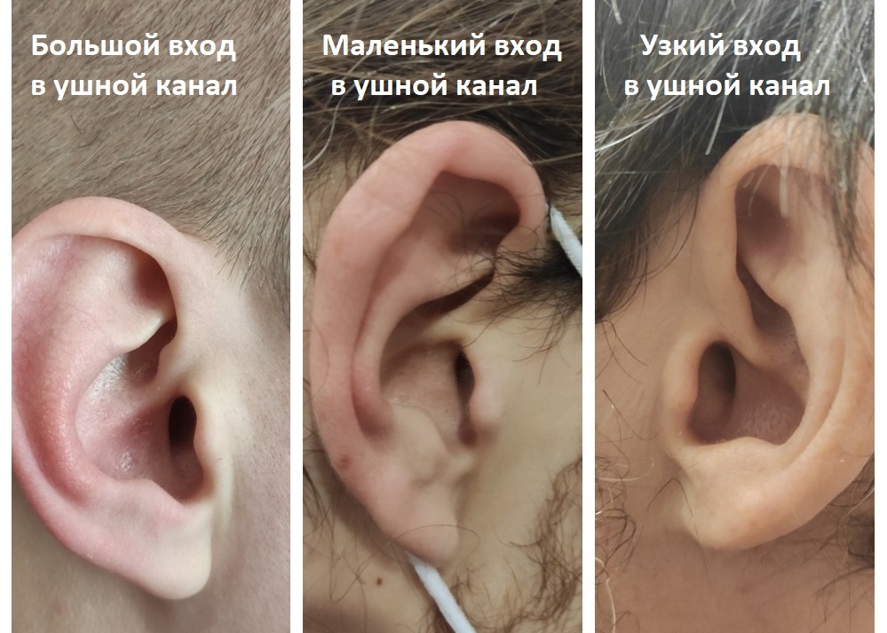 Сравнение размеров входа в ухо