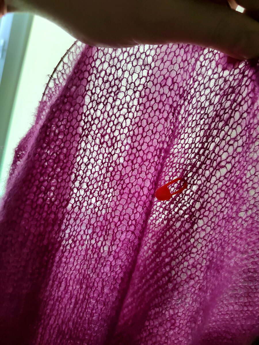 Затяжной паутинистый процесс 