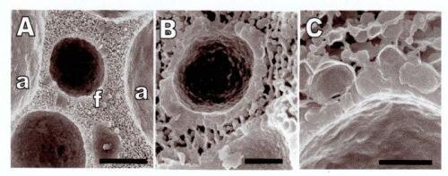 темное — пузырики воздуха, вокруг — жир