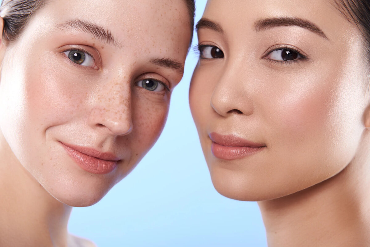 Убрать веснушки и другие пигментные пятна помогут отбеливающие кремы