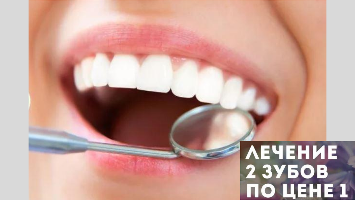 Лечу зубы по акции