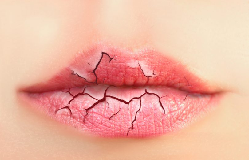 Почему сохнут губы? | 6 Советов от Kodi Professional