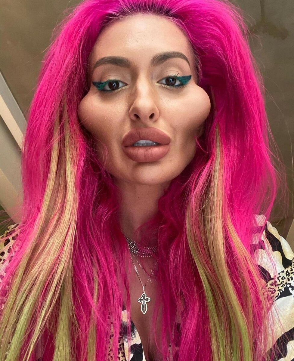 Результаты инъекций