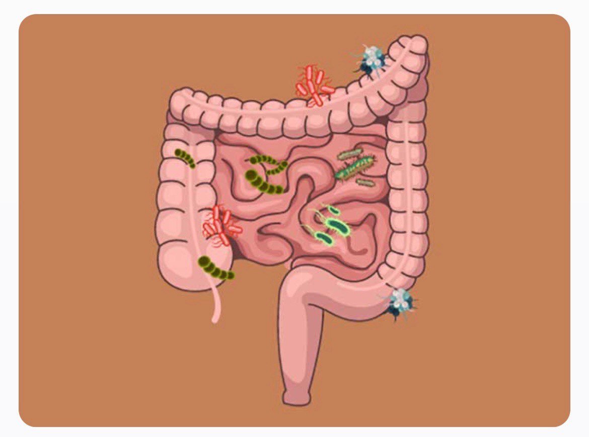 Микрофлора кишечника картинка