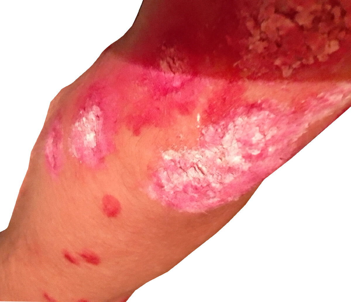 рука больного