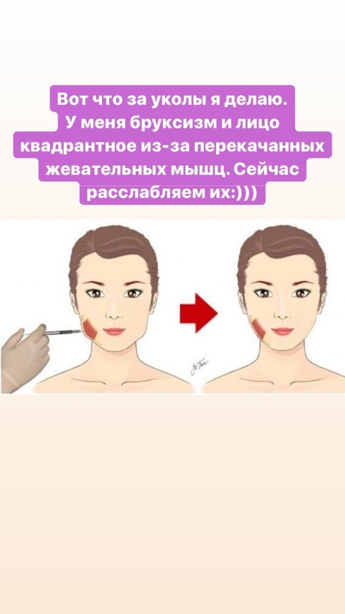 Девушка решила изменить овал лица
​Фото: «Инстаграм»