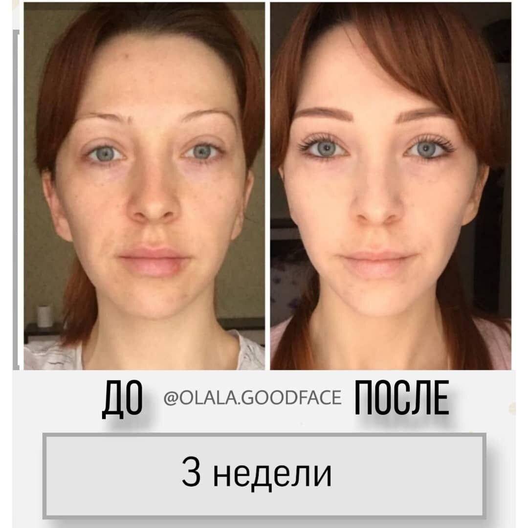 Фейс лицо фото до и после