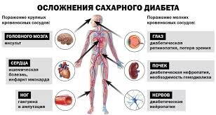 Гипергидроз - причины появления, при каких заболеваниях возникает, диагностика и способы лечения