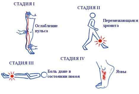 Велотренировки не дадут болезни прогрессировать