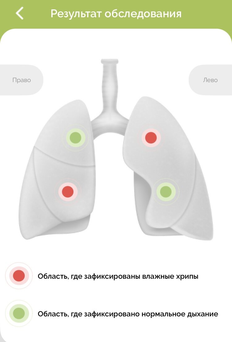Скриншот со специальной программы, которая помогает прибору выявлять опасные симптомы 