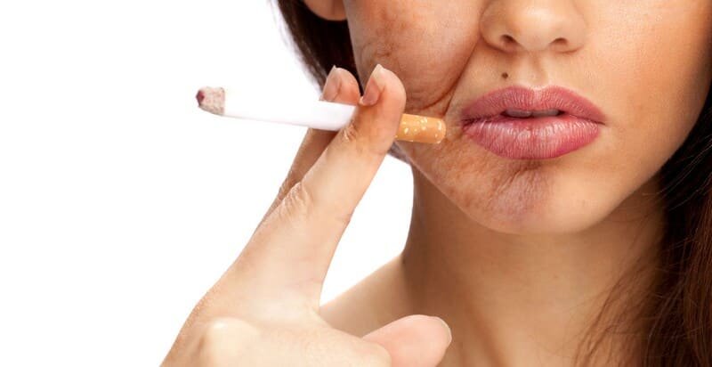 Как курение влияет на кожу: последствия курения сигарет для кожи лица,  средства для восстановления кожи после отказа от курения | Косметология и  эстетическая медицина | Дзен