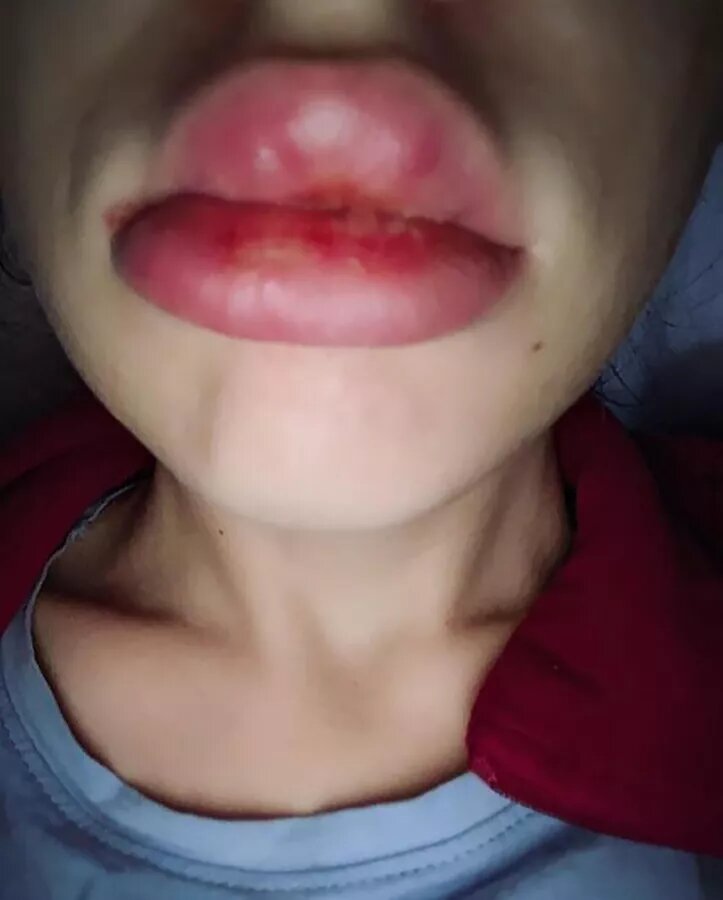 -2