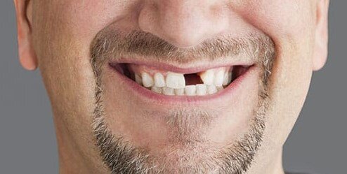 Фото взято из Яндекс.Картинки