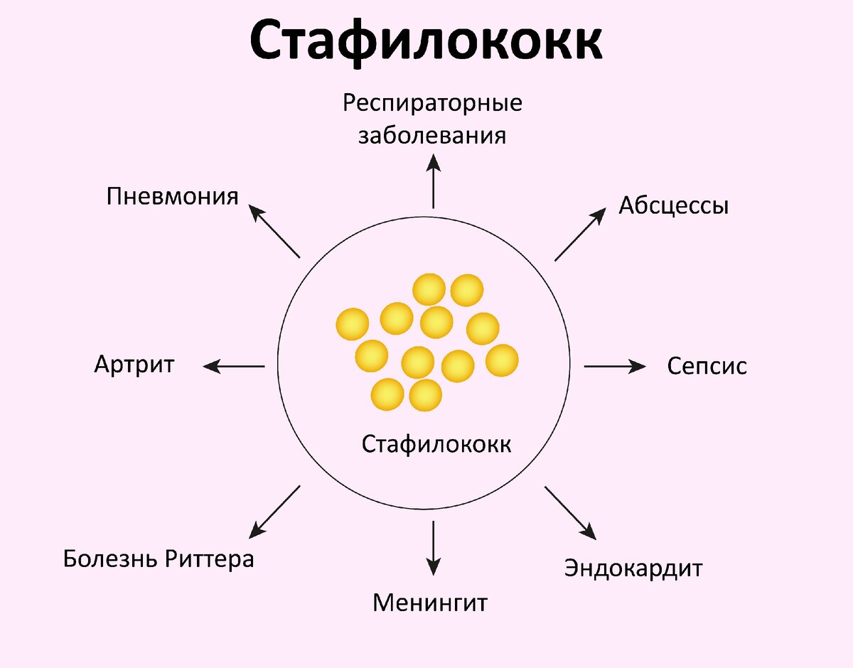 Кишечные инфекции: стафилококк, сальмонелез — симптомы, лечение