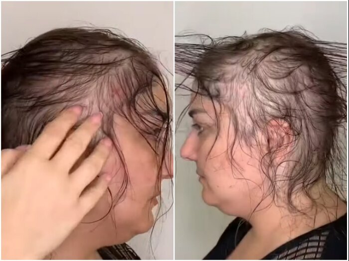 Сложно даже представить, что можно сделать с такими редкими волосами. | Фото: youtube.com/ © Vasily Шевченко.