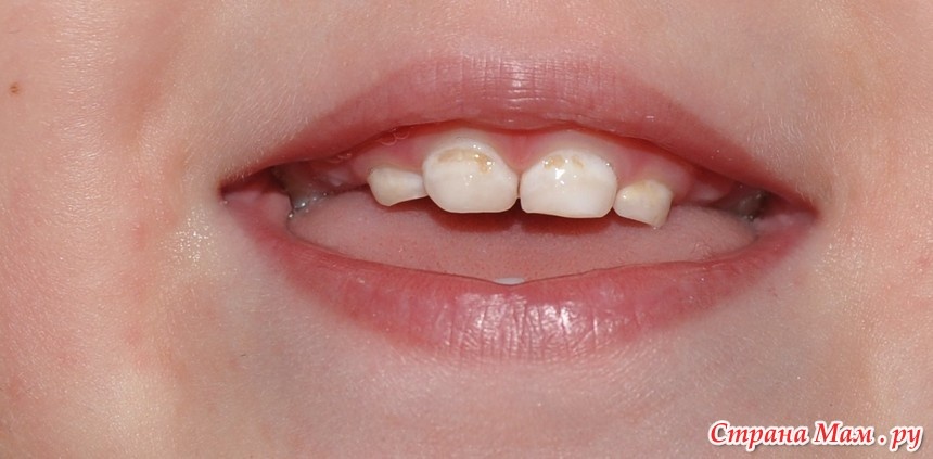 Яндекс картинки 