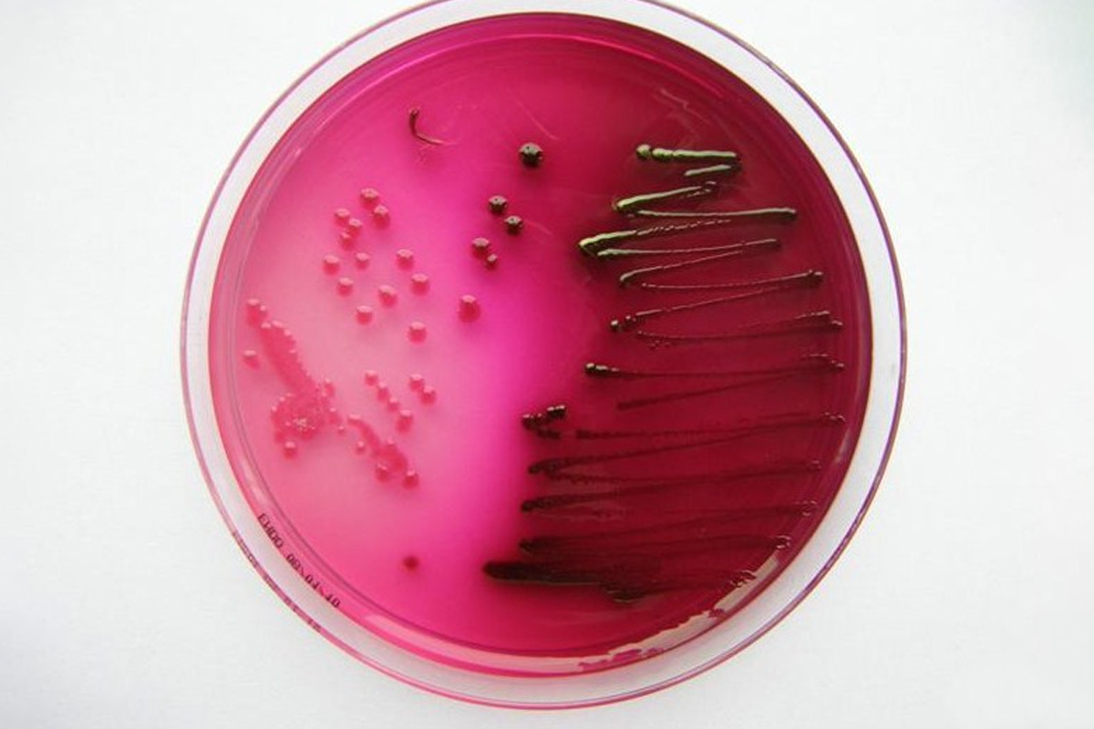 Чашка петри со средой. Кишечная палочка на среде Эндо. Escherichia coli на среде Эндо. Агар Эндо микробиология. Рост бактерий на среде Эндо.