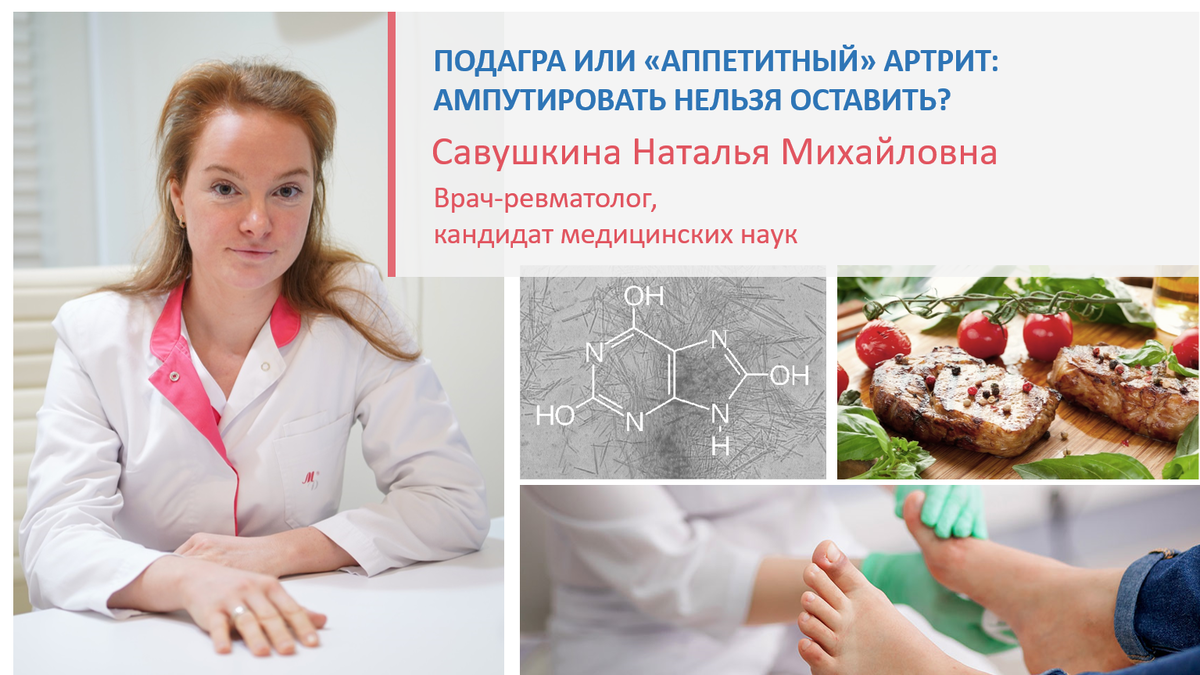 Диета при подагре: списки продуктов, меню на неделю - FitoMarket