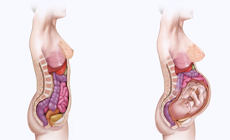 Внутренние органы при беременности. Для них остается мало места. Поджатый кверху желудок, пережатый "в плюху" кишечник, сдавленный мочевой пузырь. Фото с сайта lechusdoma.ru