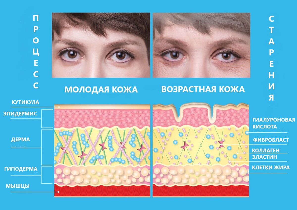 Старение кожи