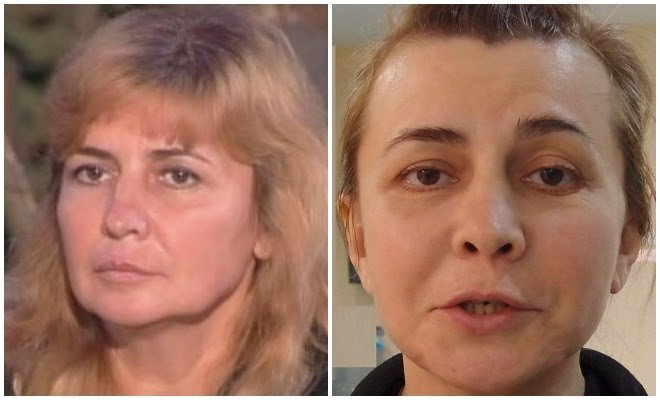Фото вали карнавал до пластики и после Пластиковые" провалы на "Доме-2": звёзды телестройки до и после неудачной пласти