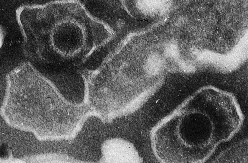Вирионы вируса. Капсиды – круглые защитные белковые оболочки, свободно окруженные мембраной. Фото: Liza Gross/wikipedia