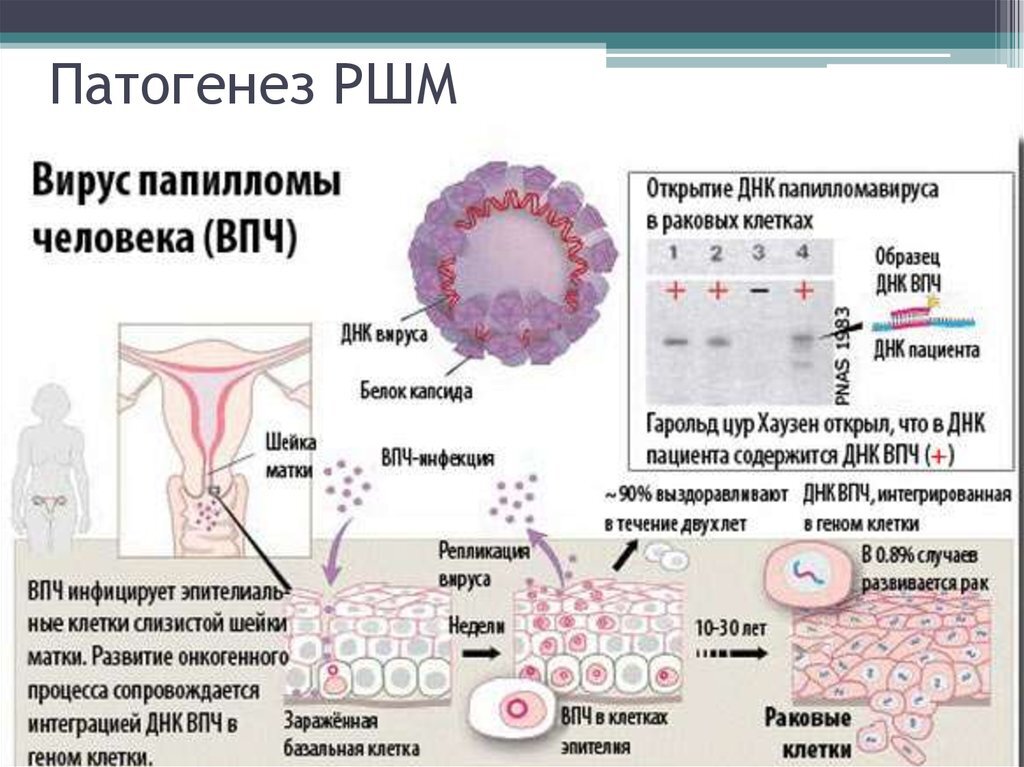 Лечение аногенитальных трещин