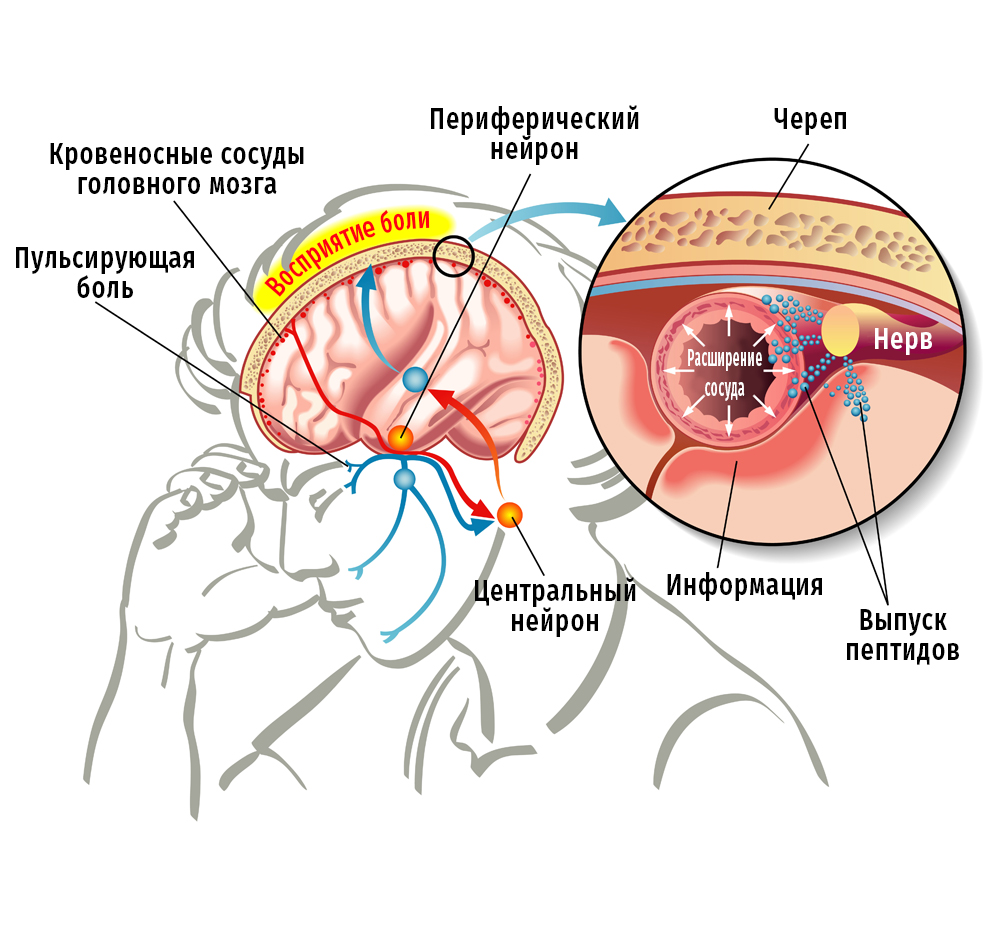 Клиническая картина