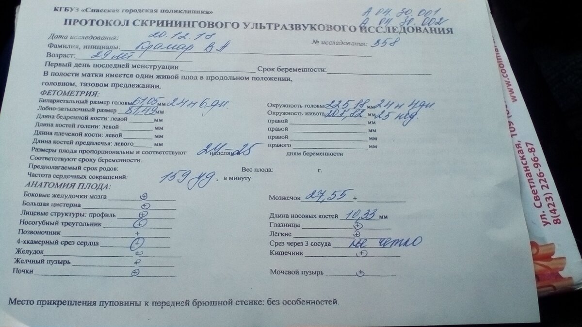 Фото автора, УЗИ-1