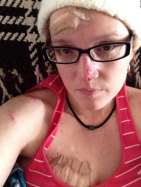 Лиза Пэйс после операций