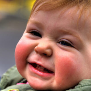 Общей чертой всех этих патологических состояний является похожие клинические проявления - это высыпания в виде: