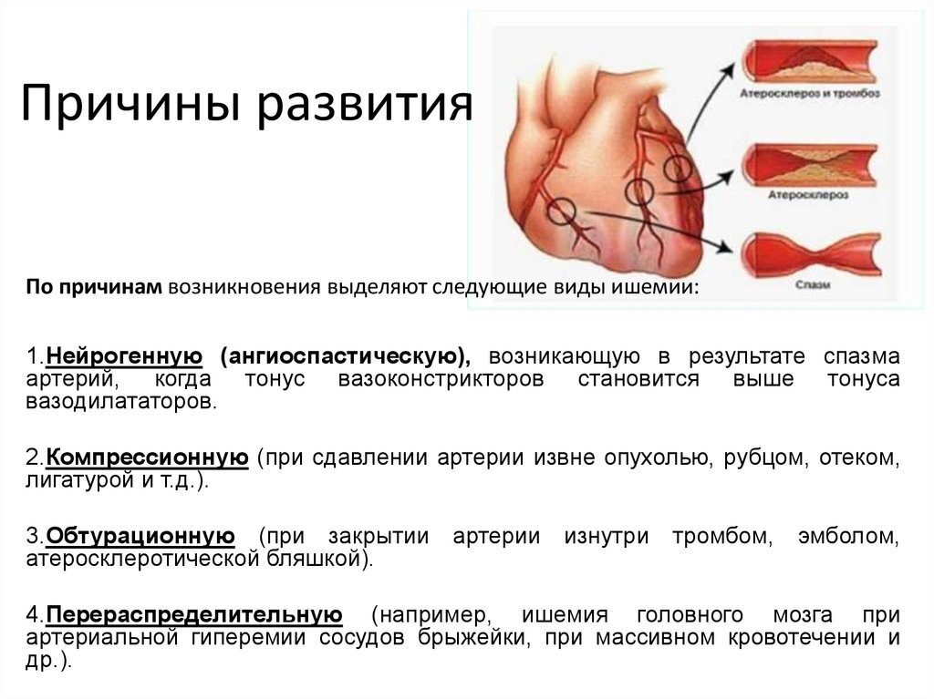 Сосудистая мозговая недостаточность.