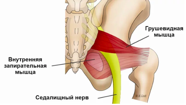 Йогатерапия при защемлении седалищного нерва и синдроме грушевидной мышцы.