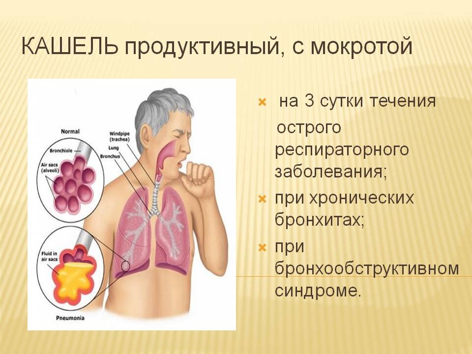 Пневмония. Что нужно знать о воспалении легких