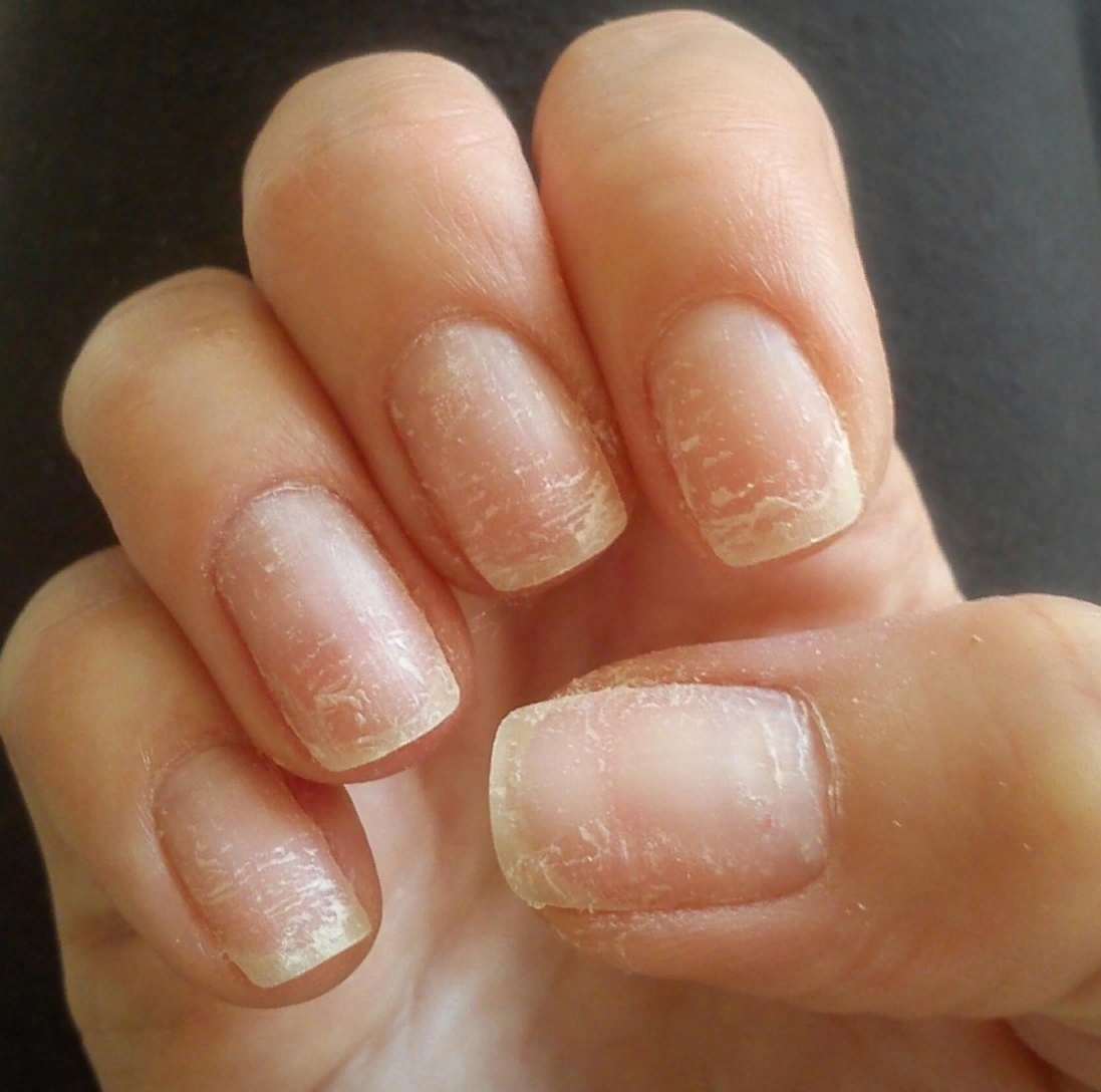 Фото для иллюстрации взято с сайта med-look.ru