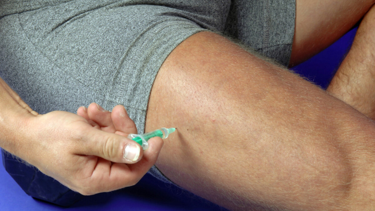 Техника выполнения внутримышечной инъекции в ягодицу. Место для внутримышечной инъекции в бедро. Поставить укол себе в ногу видео. Схема внутримышечной инъекции в ягодицу. Бедро алгоритм внутримышечной инъекции.