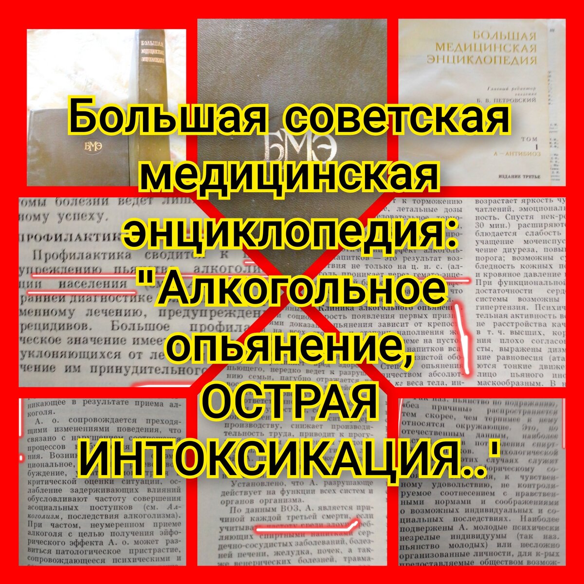 Скрины Большой медицинской энциклопедии 1974 года начала издания, называющей алкоголь и алкогольные состояния своими именами