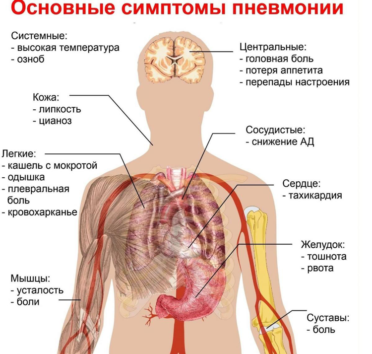 Лечение пневмонии в домашних условиях и в стационаре | Philips