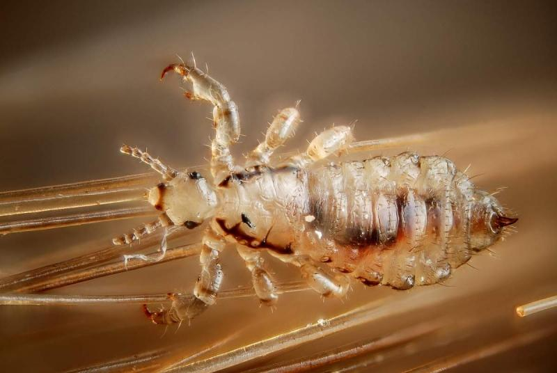 Головная вошь