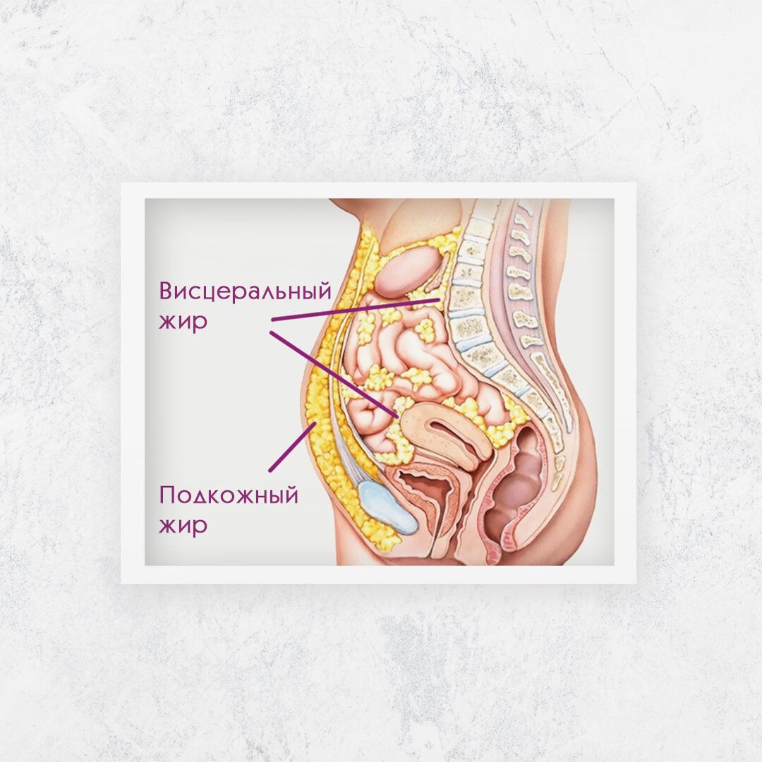 Висцеральный жир картинка